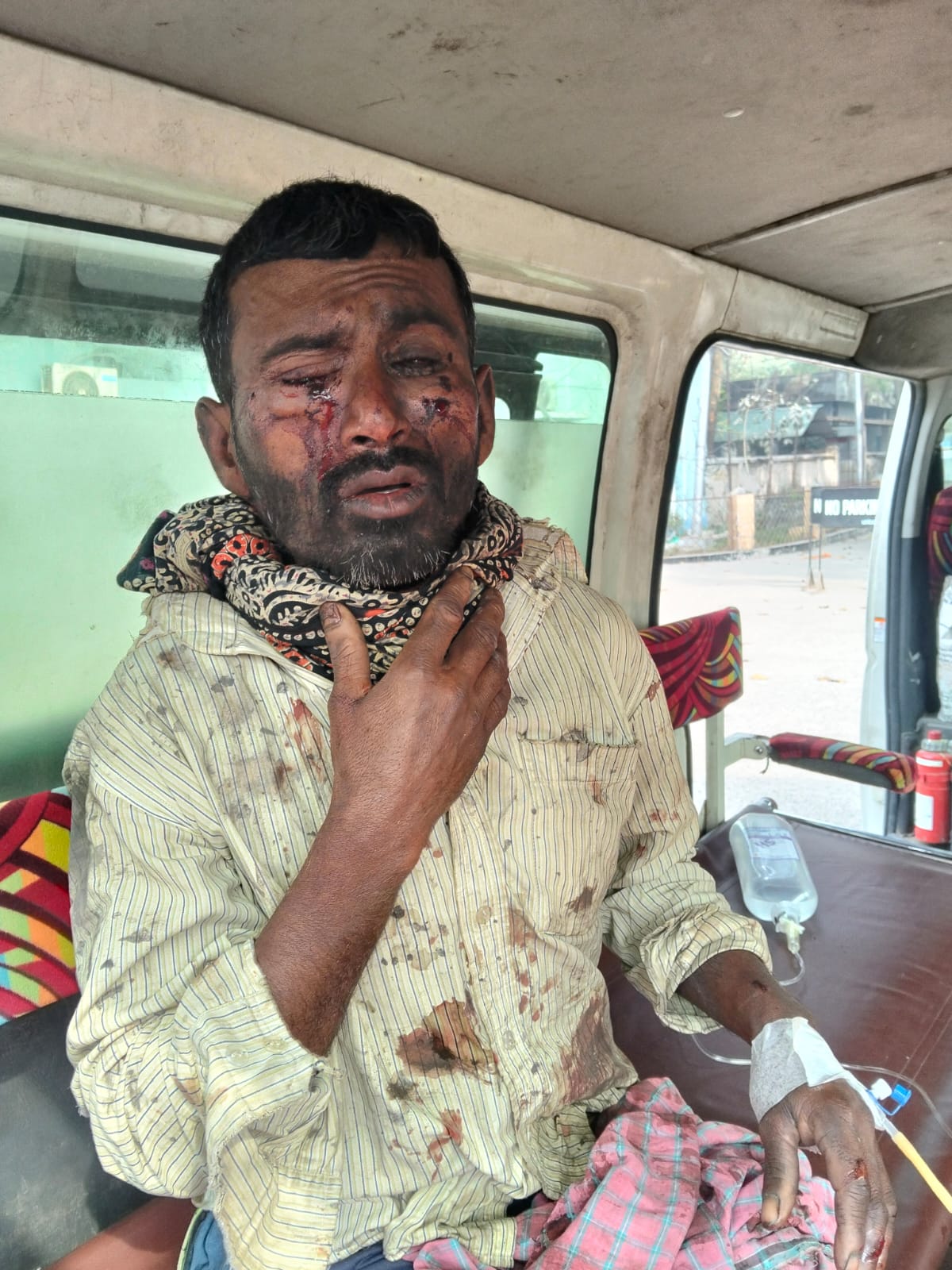 শার্শা বালুন্ডা গ্রামে ককটেল বিস্ফোরনে দুই শ্রমিক আহত।