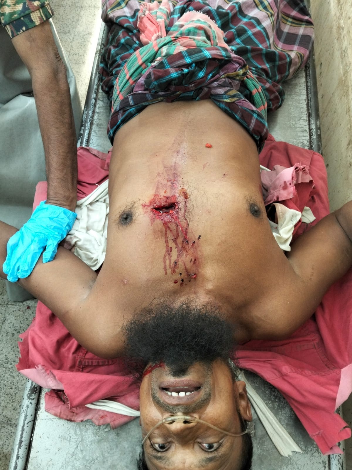 বেনাপোল বন্দরে ক্রেনের দুর্ঘটনায় শ্রমিক গুরুতর আহত।